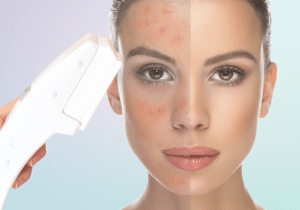 6 Coisas que podem envelhecer sua pele